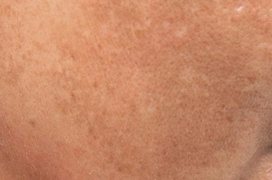 Wangenpartie mit sichtbaren Pigmentflecken und leicht unebenem Hautton